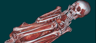 Illustration for article titled Everything We've Learned About Mummies Using 21st Century Technology